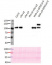 V-ATPase, a3 | vacuolar H+-ATPase subunit a isoform 3